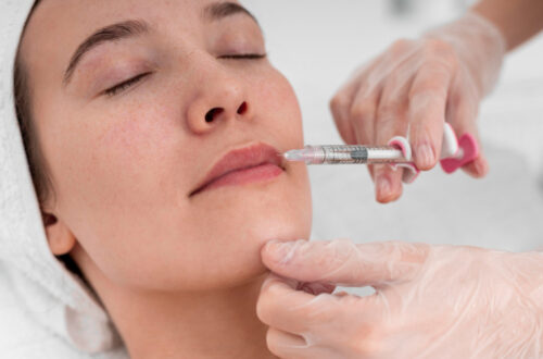 lipfiller-treatment-kristal-clinics