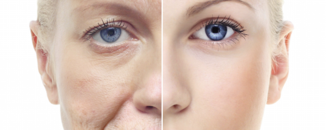 The ultimate guide to reducing wrinkles under the eyes using fillers