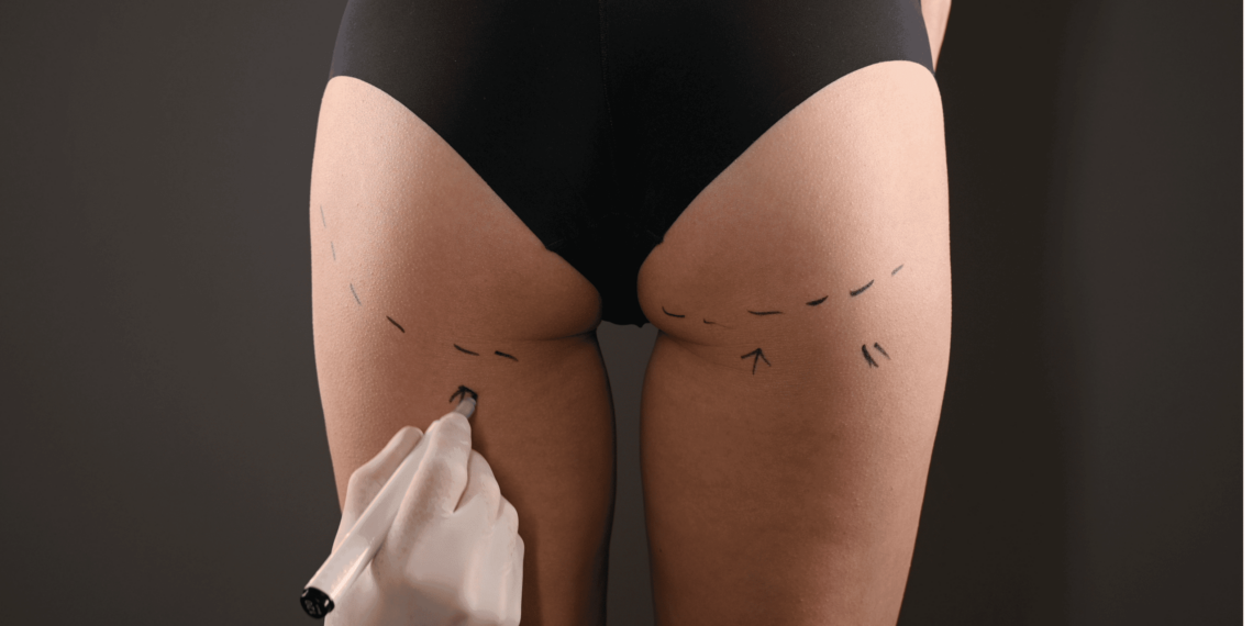 Tips for shapely buttocks