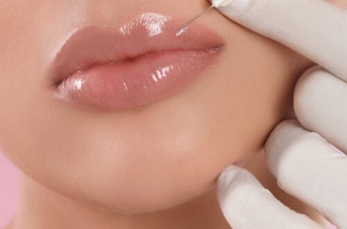 Odkryj magię kwasu hialuronowego w zabiegach wypełniania ust