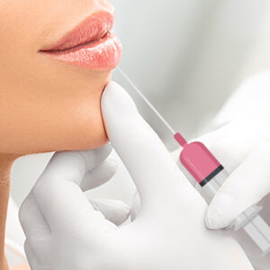 5 неоспоримых преимуществ филлеров для губ