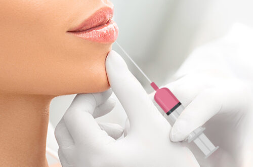5 avantages indéniables des produits de comblement des lèvres
