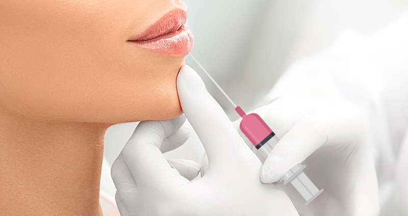 5 неоспоримых преимуществ филлеров для губ